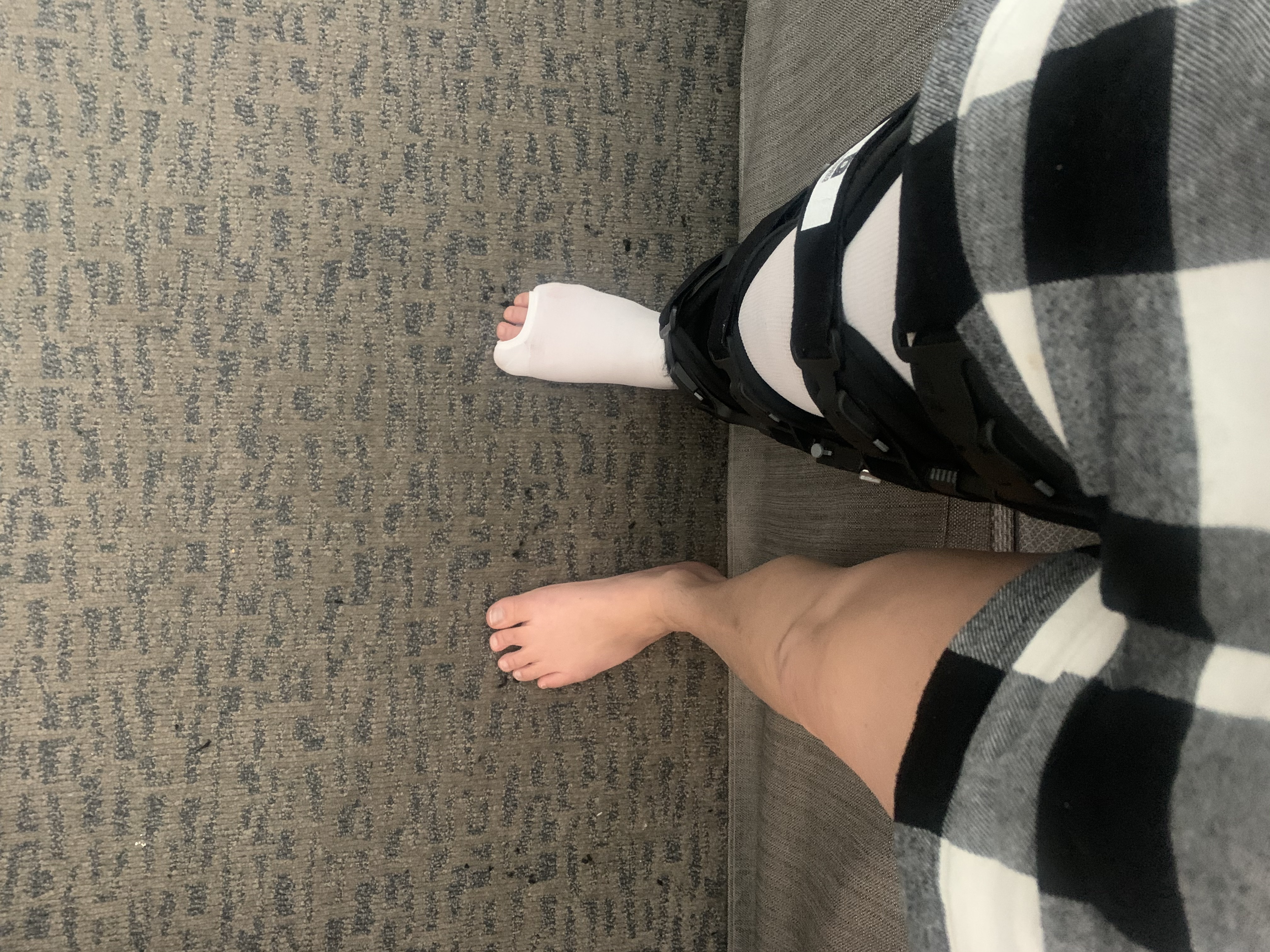 ACL Quad Tendon Reconstruction Personal Experience Blog